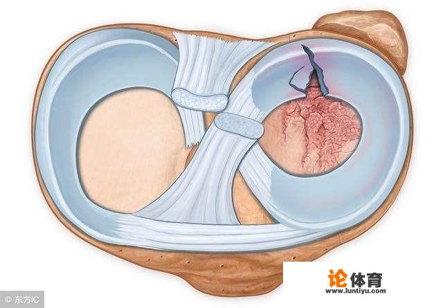 膝盖疼痛怎么办