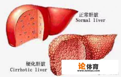 “肝脏超声”，若结果单上有这几个字，医生常神情凝重，提示肝脏有事