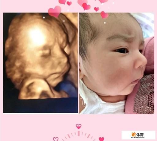 胎盘会从前壁变后壁吗?为什么? 胎盘会从前壁变后壁吗?为什么?